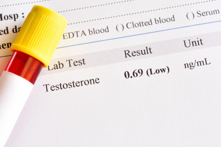 A Guide to the Testosterone Replacement Therapy Recovery Process