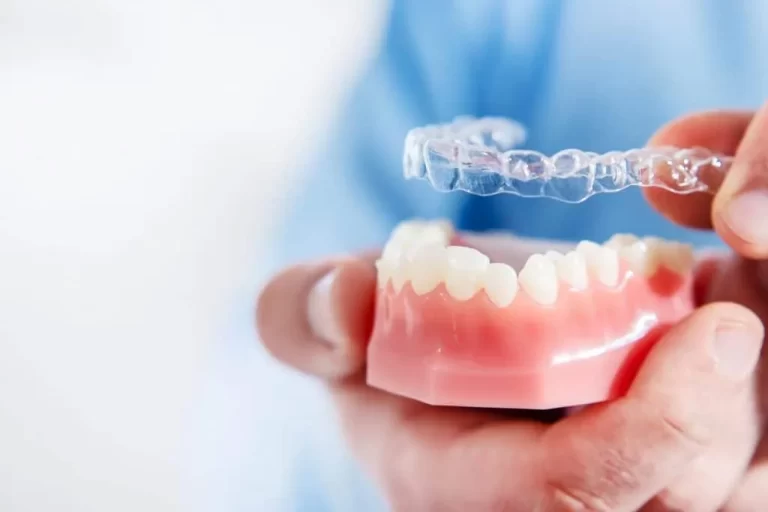 Finding Your Perfect Smile: Tips for Choosing the Right Orthodontist in North Vancouver